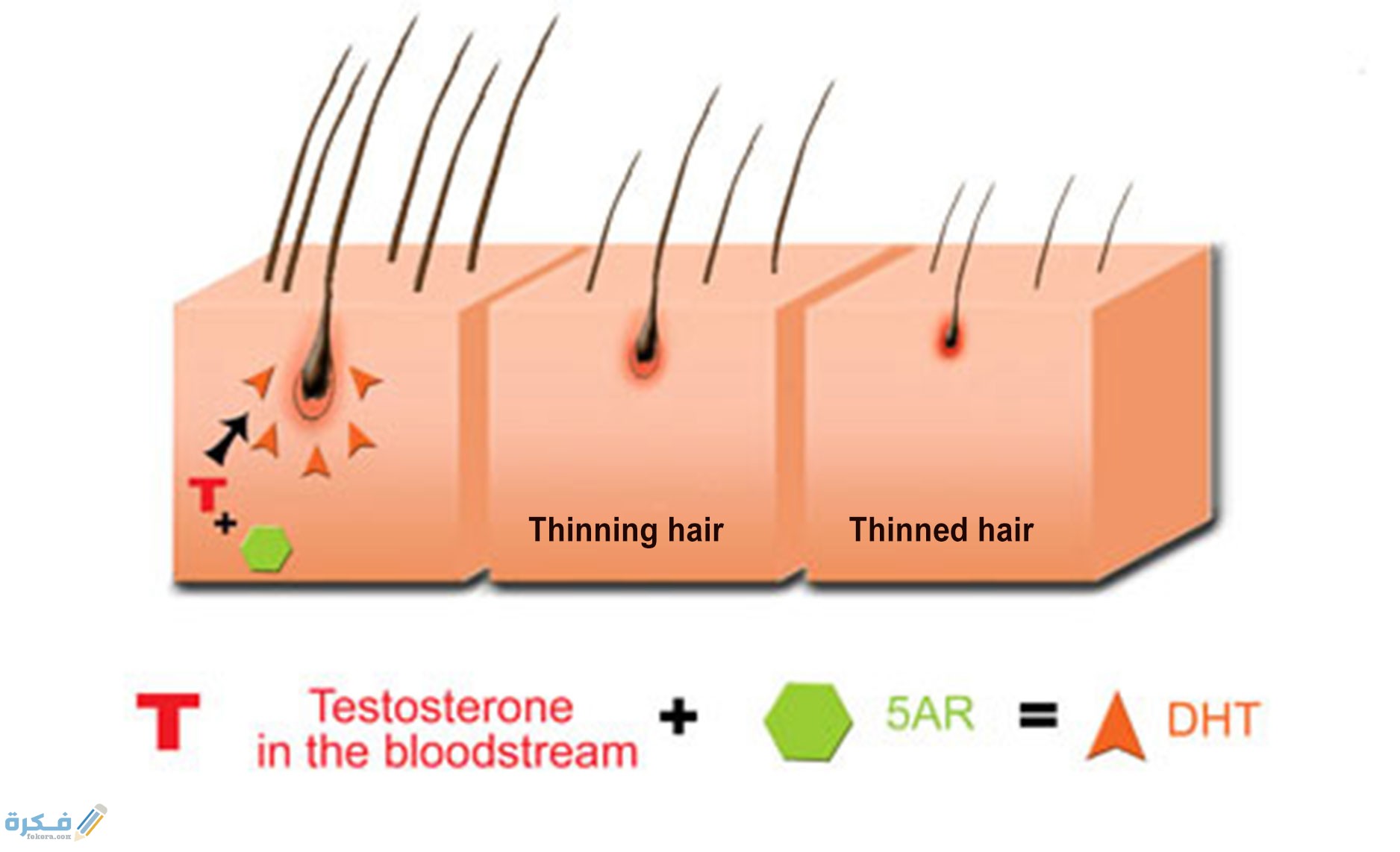 مشروبات توقف هرمون dht6 2 مشروبات توقف هرمون dht 6