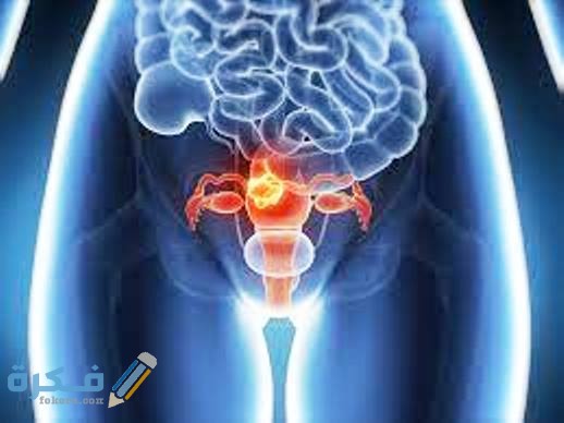 تكلفة عملية استئصال الرحم 2 تكلفة عملية استئصال الرحم