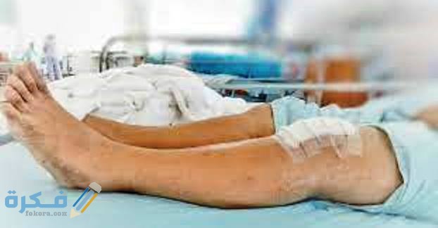 كم تكلفة عملية غضروف الركبة بالمنظار في مصر 4 إجراءات ما بعد عملية الغضروف