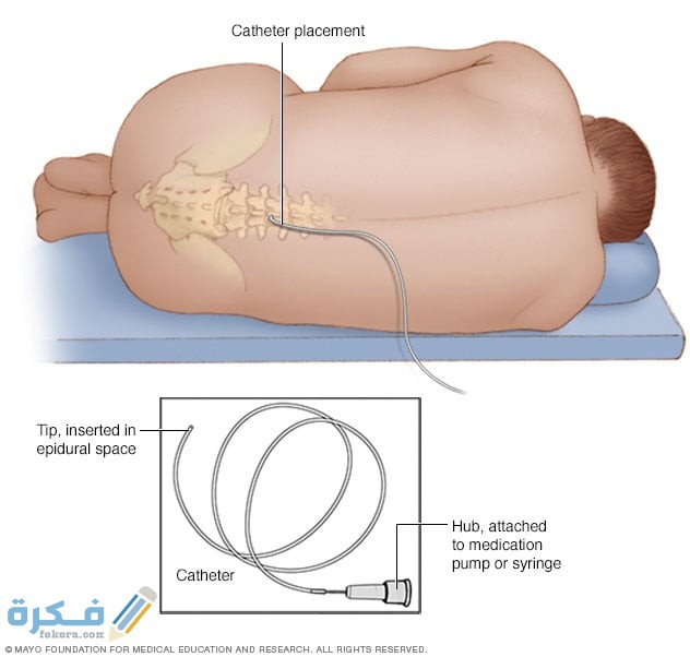 اقوي مسكن بعد العمليات الجراحية اقوي مسكن بعد العمليات الجراحية