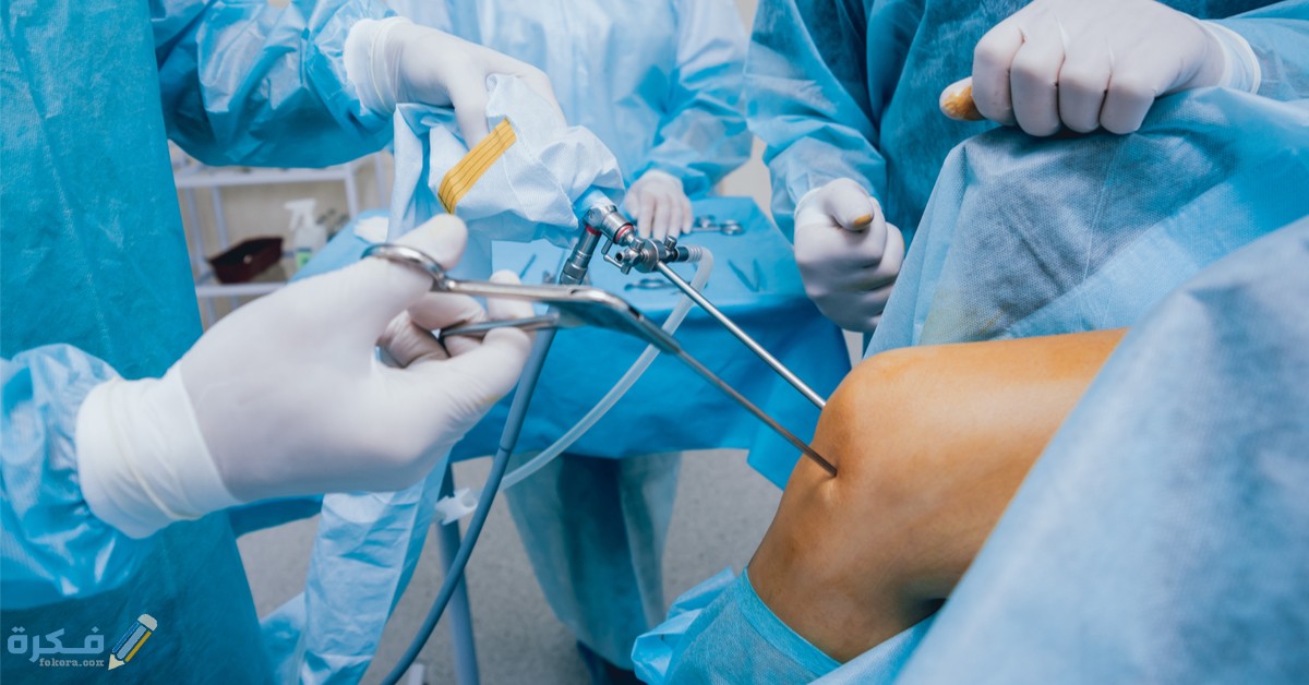 كم تكلفة عملية غضروف الركبة بالمنظار في مصر 3 تكلفة عملية غضروف الركبة في مصر