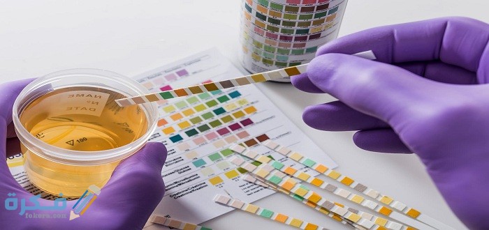 ماهي الأدوية التي تؤثر على تحليل المخدرات ماهي الأدوية التي تؤثر على تحليل المخدرات