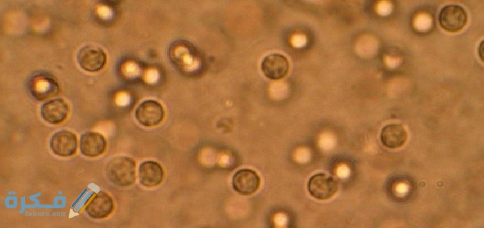 ما معنى Aspect في تحليل البول ما معنى Aspect في تحليل البول