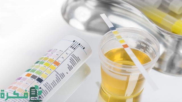 علاج اصفرار البول علاج اصفرار البول