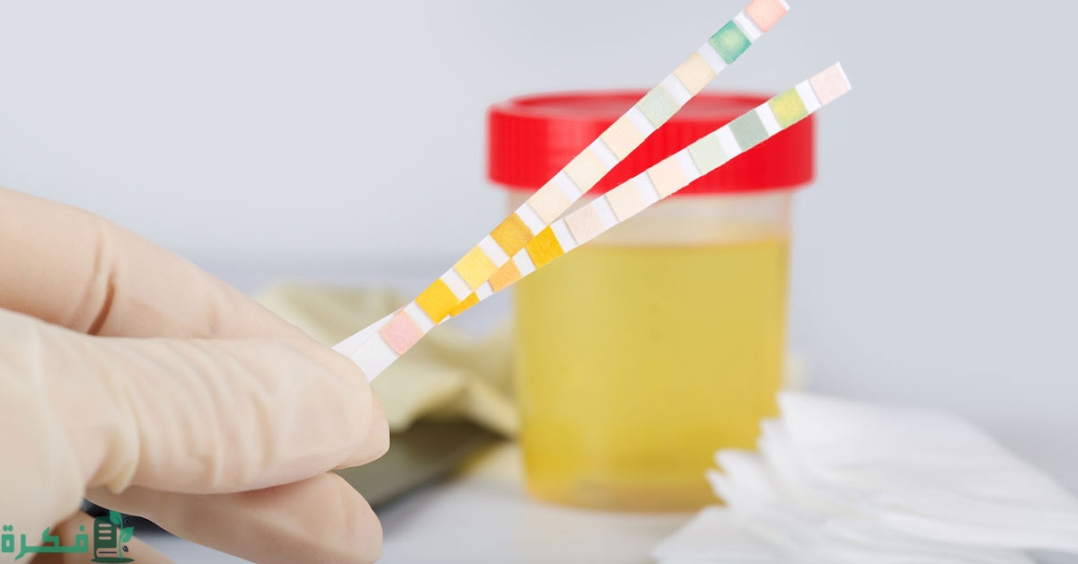 ما هو علاج اصفرار البول