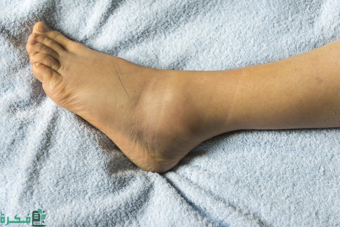 اسماء التحاليل المطلوبة لتورم القدمين