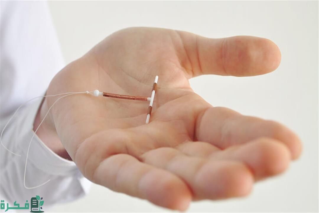 هل يمكن إزالة اللولب بدون دورة