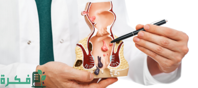 أسماء احسن 5 أنواع مرهم لعلاج الشرخ 2 أفضل 5 أنواع مرهم لعلاج الشرخ