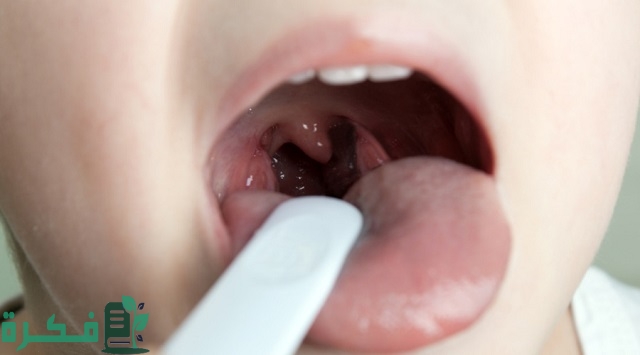 أسماء احسن 5 أنواع مضاد حيوي لعلاج التهاب اللوزتين للأطفال