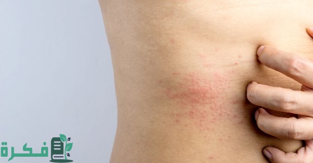 ظهور حبوب في الجسم أثناء الحمل وجنس الجنين ظهور حبوب في الجسم أثناء الحمل وجنس الجنين