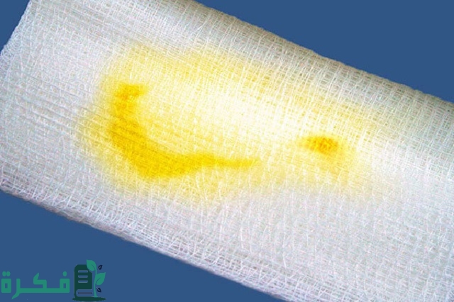 هل الافرازات الصفراء من علامات قرب الولادة